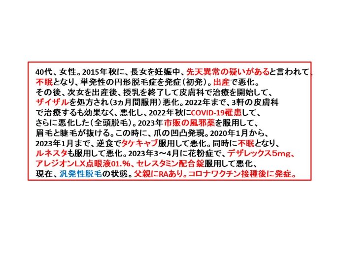 円形脱毛症　病院